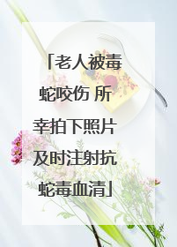 老人被毒蛇咬伤 所幸拍下照片及时注射抗蛇毒血清
