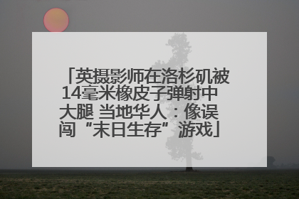 英摄影师在洛杉矶被14毫米橡皮子弹射中大腿 当地华人：像误闯“末日生存”游戏